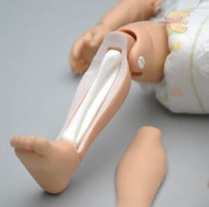 Intraosseous Access Intraosseous infusion and injection system with realistic tibia bones.